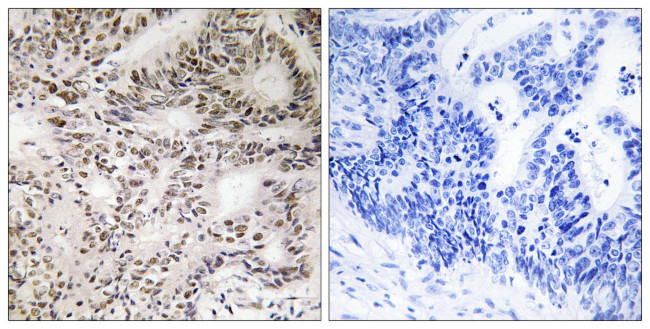 Phospho-A-Raf (Ser299) Antibody in Immunohistochemistry (Paraffin) (IHC (P))