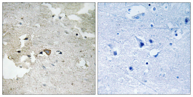 Phospho-Axl (Tyr691) Antibody in Immunohistochemistry (Paraffin) (IHC (P))