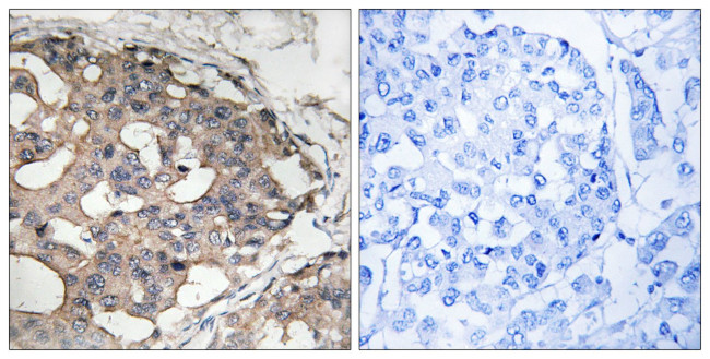 Phospho-B-Raf (Ser446) Antibody in Immunohistochemistry (Paraffin) (IHC (P))