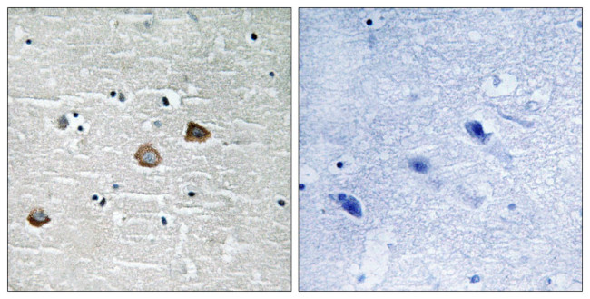 Phospho-CaMKII beta/gamma/delta (Thr287) Antibody in Immunohistochemistry (Paraffin) (IHC (P))