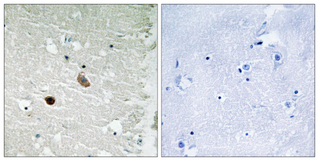 CaMKII beta/gamma/delta Antibody in Immunohistochemistry (Paraffin) (IHC (P))