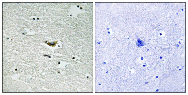Phospho-CK1 alpha (Tyr294) Antibody in Immunohistochemistry (Paraffin) (IHC (P))