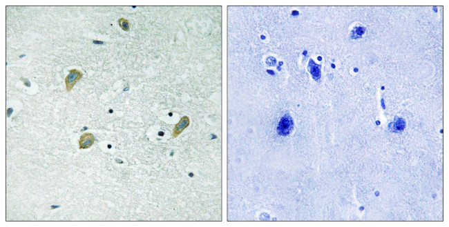 CK1 gamma Antibody in Immunohistochemistry (Paraffin) (IHC (P))