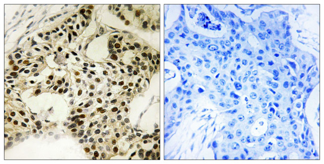 Phospho-LKB1 (Ser334) Antibody in Immunohistochemistry (Paraffin) (IHC (P))