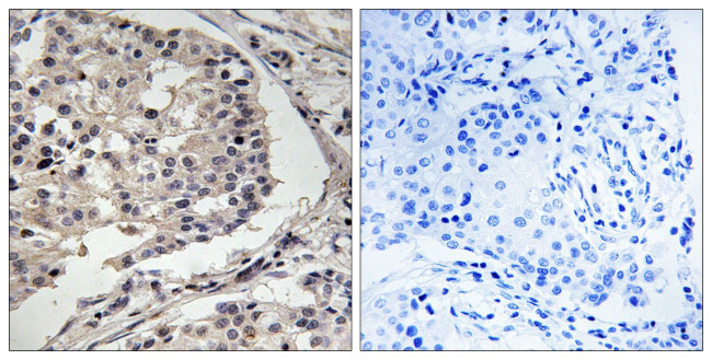 MLK1/MLK2 Antibody in Immunohistochemistry (Paraffin) (IHC (P))