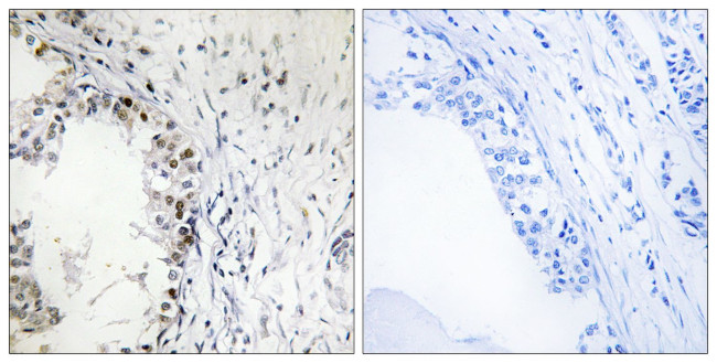Phospho-MNK1 (Thr250) Antibody in Immunohistochemistry (Paraffin) (IHC (P))