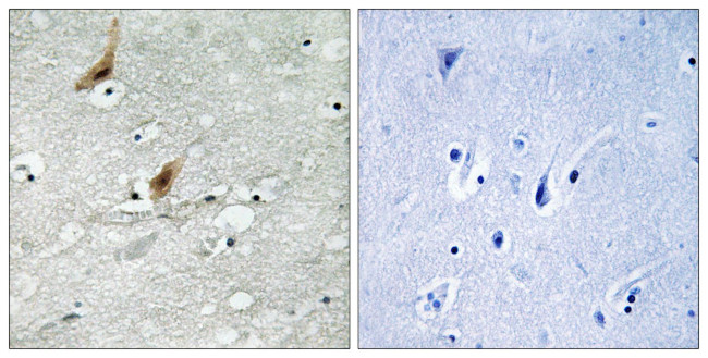 Phospho-MSK2 (Thr568) Antibody in Immunohistochemistry (Paraffin) (IHC (P))