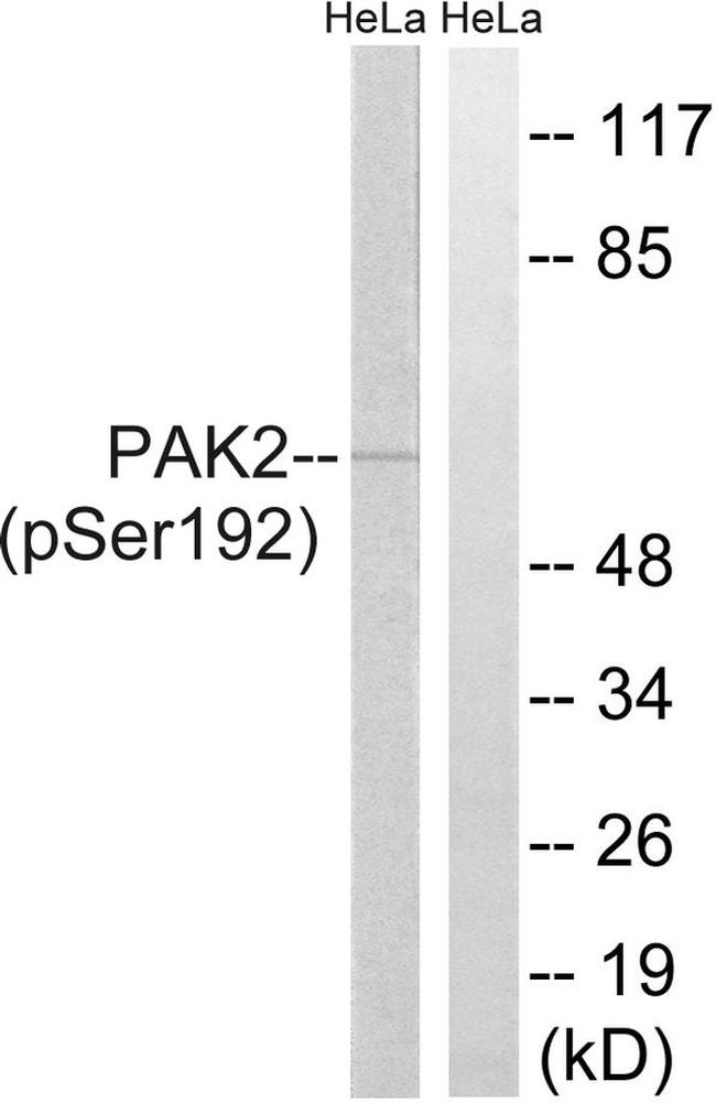Phospho-PAK2 (Ser192) Antibody in Western Blot (WB)