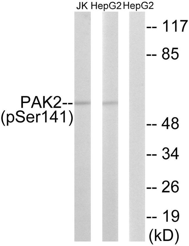 Phospho-PAK2 (Ser141) Antibody in Western Blot (WB)