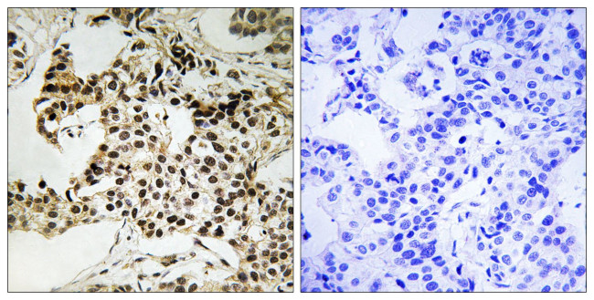 Phospho-PKR (Thr258) Antibody in Immunohistochemistry (Paraffin) (IHC (P))