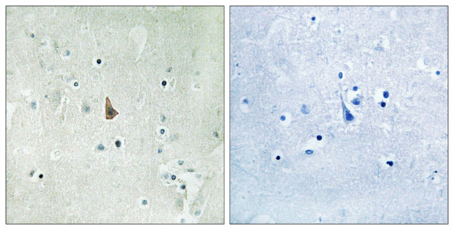 Phospho-TrkC (Tyr516) Antibody in Immunohistochemistry (Paraffin) (IHC (P))