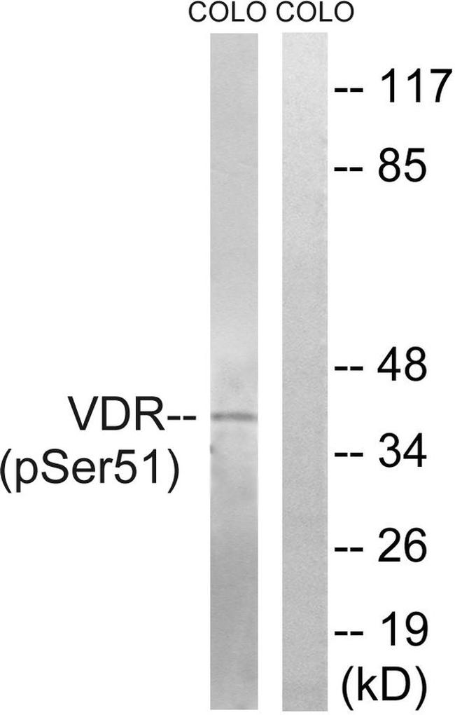 Phospho-VDR (Ser51) Antibody in Western Blot (WB)
