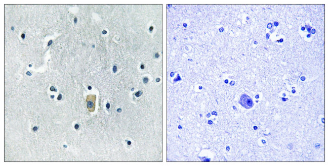 Phospho-Bim (Ser59) Antibody in Immunohistochemistry (Paraffin) (IHC (P))