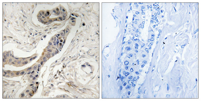 Phospho-Bcl-X (Thr115) Antibody in Immunohistochemistry (Paraffin) (IHC (P))