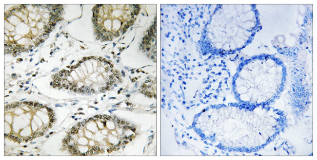 Phospho-ATR (Ser428) Antibody in Immunohistochemistry (Paraffin) (IHC (P))