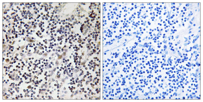 Phospho-Estrogen Receptor beta (Ser87) Antibody in Immunohistochemistry (Paraffin) (IHC (P))