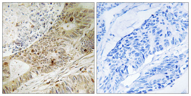 Phospho-ATRIP (Ser224) Antibody in Immunohistochemistry (Paraffin) (IHC (P))