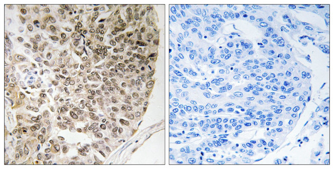 Phospho-Caldesmon (Ser759) Antibody in Immunohistochemistry (Paraffin) (IHC (P))