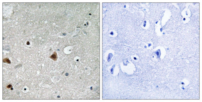 Phospho-GPS1 (Ser454) Antibody in Immunohistochemistry (Paraffin) (IHC (P))