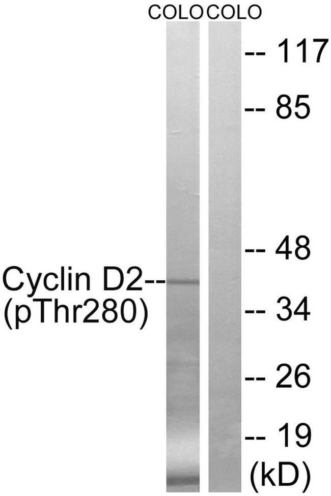 Phospho-Cyclin D2 (Thr280) Antibody in Western Blot (WB)