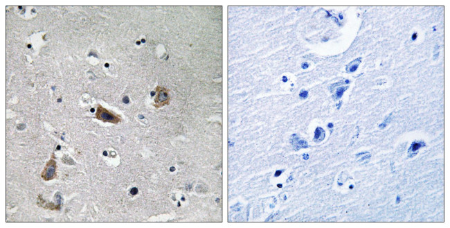 Phospho-Doublecortin (Ser376) Antibody in Immunohistochemistry (Paraffin) (IHC (P))
