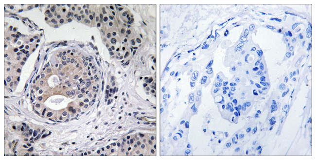 Phospho-EEF2K (Ser359) Antibody in Immunohistochemistry (Paraffin) (IHC (P))
