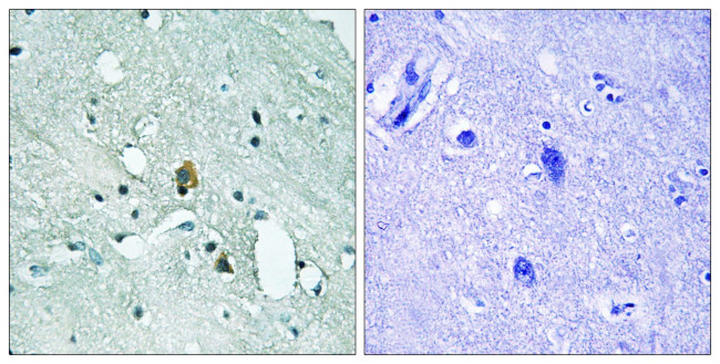 Phospho-IP3 Receptor 1 (Ser1764) Antibody in Immunohistochemistry (Paraffin) (IHC (P))