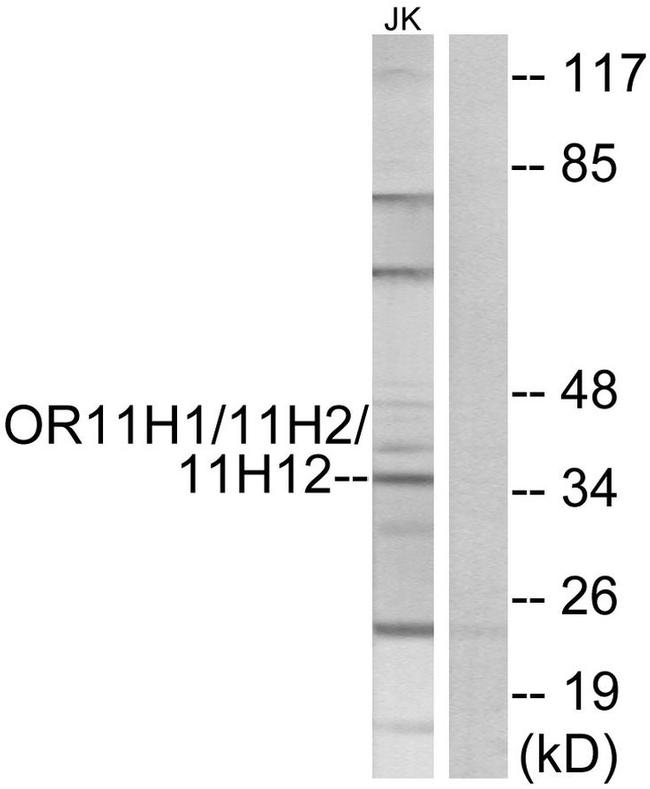 OR11H1/OR11H2/OR11H12 Antibody in Western Blot (WB)