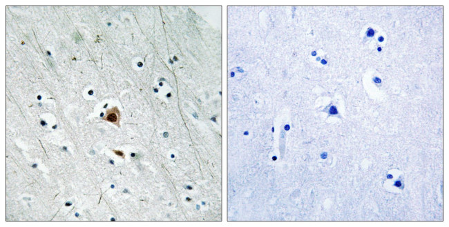 Phospho-MAPKAPK2 (Ser272) Antibody in Immunohistochemistry (Paraffin) (IHC (P))