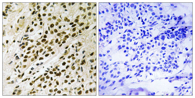 Phospho-PRAK (Thr182) Antibody in Immunohistochemistry (Paraffin) (IHC (P))