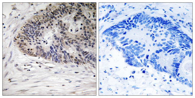 Phospho-MDMX (Ser367) Antibody in Immunohistochemistry (Paraffin) (IHC (P))