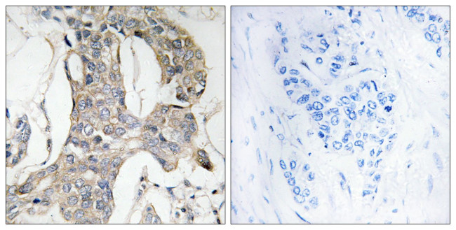 Phospho-MKP1/MKP2 (Ser296, Ser318) Antibody in Immunohistochemistry (Paraffin) (IHC (P))