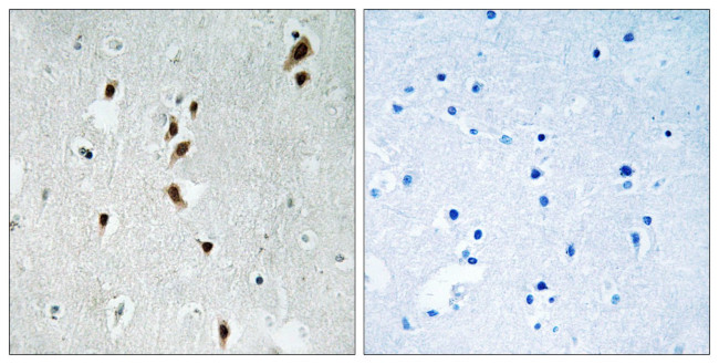 Phospho-MNK1 (Thr385) Antibody in Immunohistochemistry (Paraffin) (IHC (P))