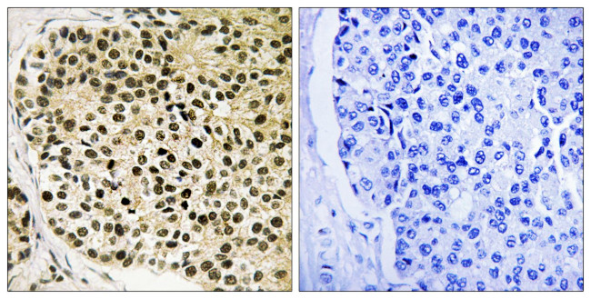 Phospho-NFATC4 (Ser168, Ser170) Antibody in Immunohistochemistry (Paraffin) (IHC (P))