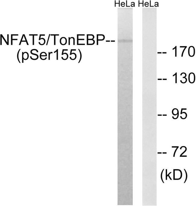Phospho-NFAT5 (Ser155) Antibody in Western Blot (WB)