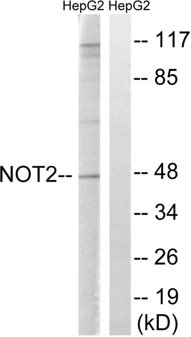 CNOT2 Antibody in Western Blot (WB)
