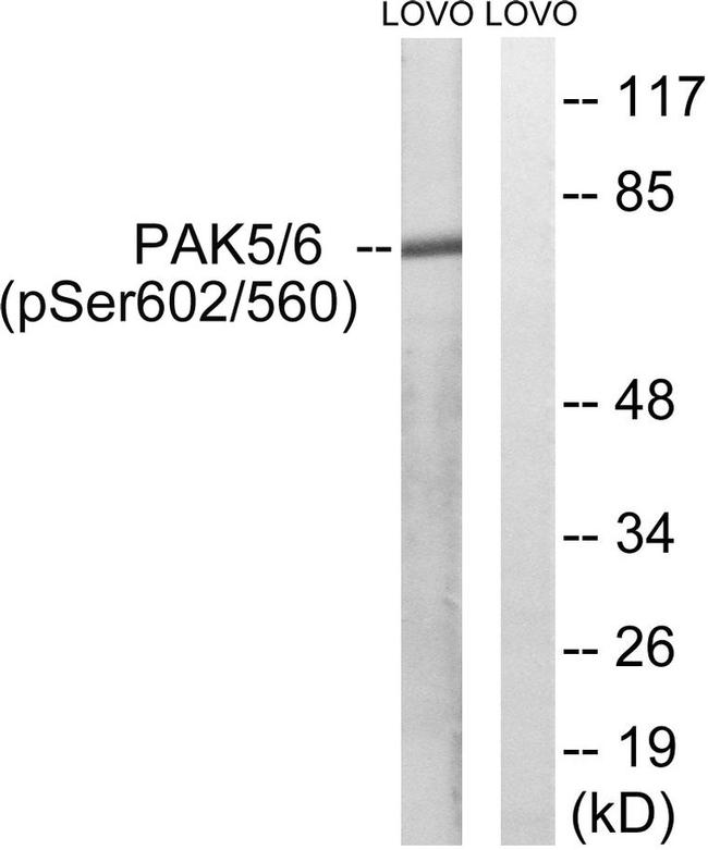 Phospho-PAK5/PAK6 (Ser602, Ser560) Antibody in Western Blot (WB)