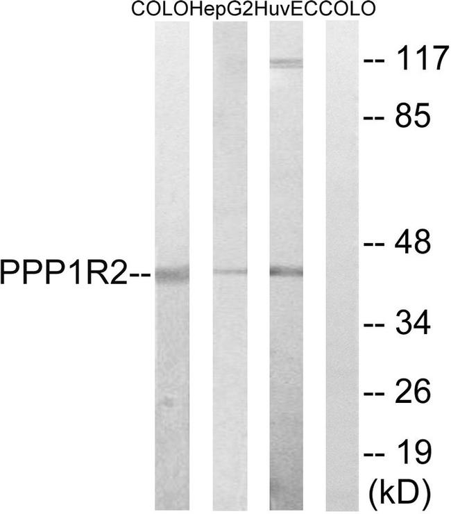 PPP1R2 Antibody in Western Blot (WB)