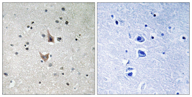 Phospho-Presenilin 1 (Ser357) Antibody in Immunohistochemistry (Paraffin) (IHC (P))