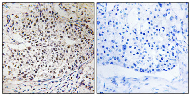 Phospho-RAD51 (Thr309) Antibody in Immunohistochemistry (Paraffin) (IHC (P))
