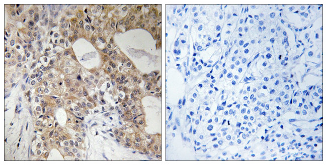 Phospho-SPHK2 (Thr614) Antibody in Immunohistochemistry (Paraffin) (IHC (P))