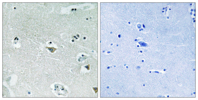 Phospho-SREBP1 (Ser439) Antibody in Immunohistochemistry (Paraffin) (IHC (P))