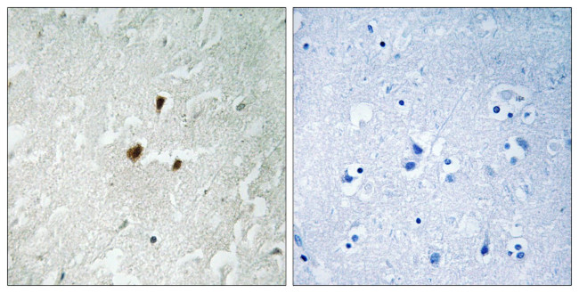 Phospho-RRN3 (Ser649) Antibody in Immunohistochemistry (Paraffin) (IHC (P))