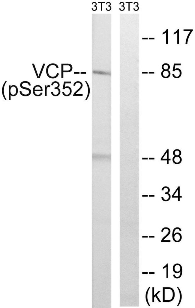 Phospho-VCP (Ser352) Antibody in Western Blot (WB)