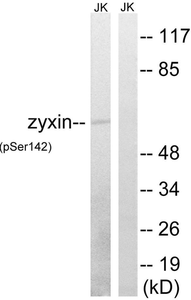 Phospho-Zyxin (Ser142) Antibody in Western Blot (WB)
