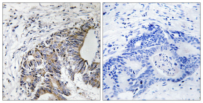 Phospho-FHIT (Tyr114) Antibody in Immunohistochemistry (Paraffin) (IHC (P))