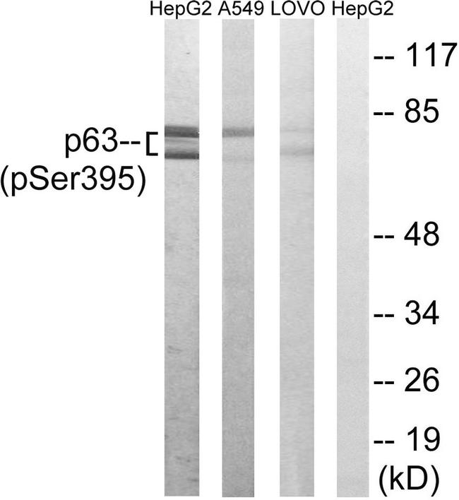 Phospho-p63 (Ser395) Antibody in Western Blot (WB)