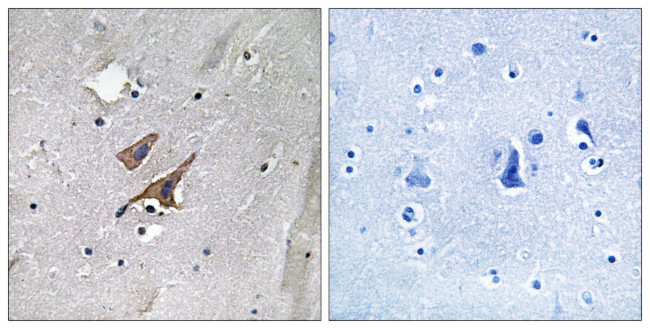 Phospho-TSC2 (Tyr1571) Antibody in Immunohistochemistry (Paraffin) (IHC (P))