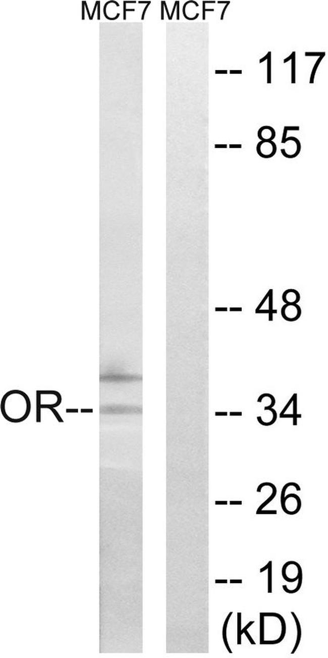 OR51H1P Antibody in Western Blot (WB)