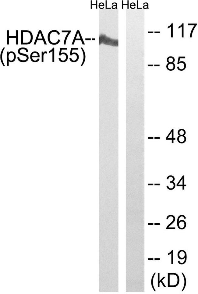 Phospho-HDAC7 (Ser155) Antibody in Western Blot (WB)